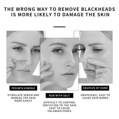 Deep Cleansing Nose Acne Blackhead Removing Strips (10)